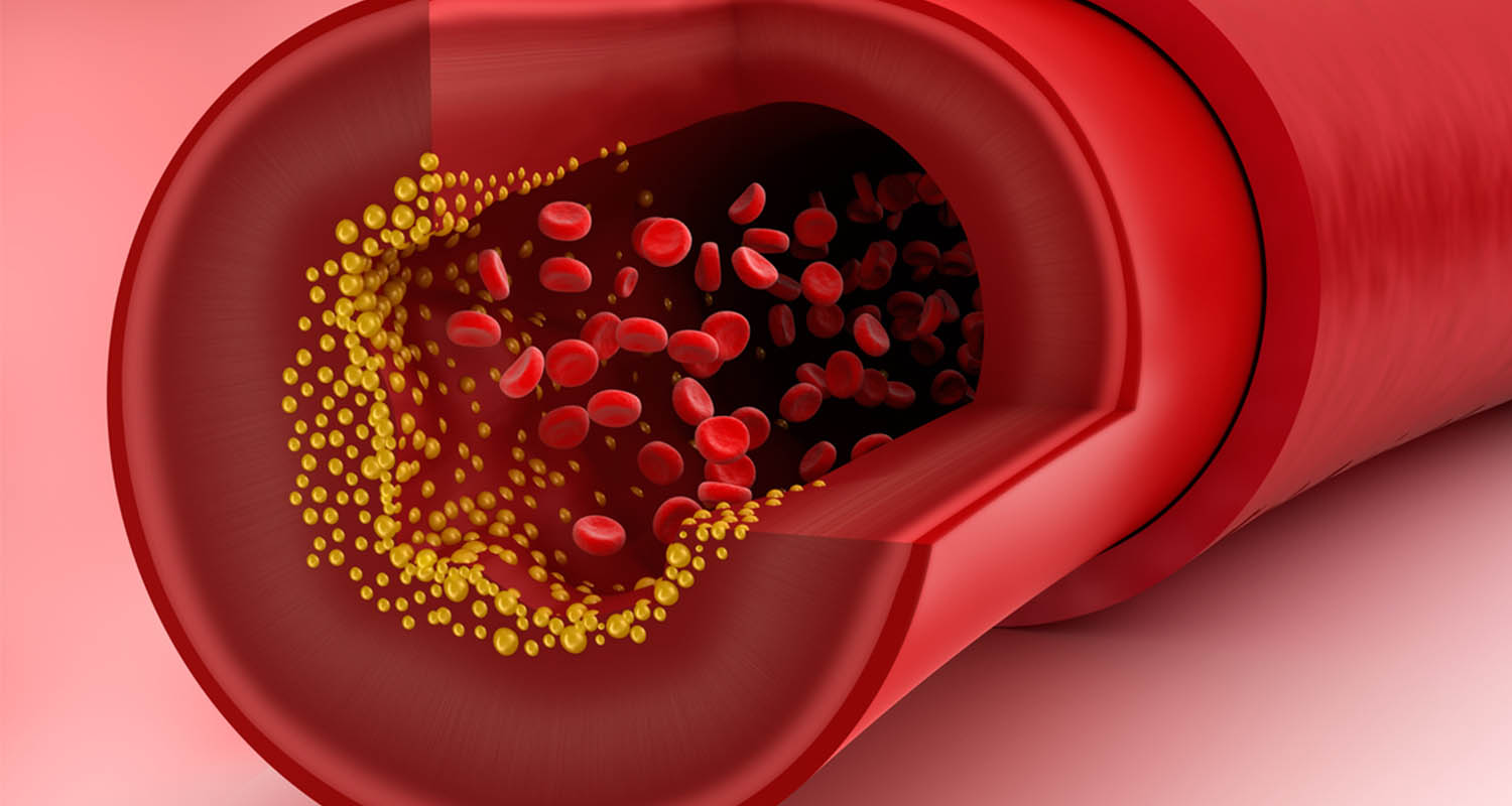 Natural ways to lower cholesterol 1